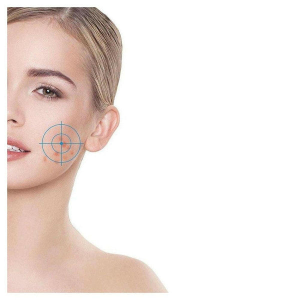 Rio Skin Revive Lite Q-acne - RIO-QACNE-Shopvoorgezondheid