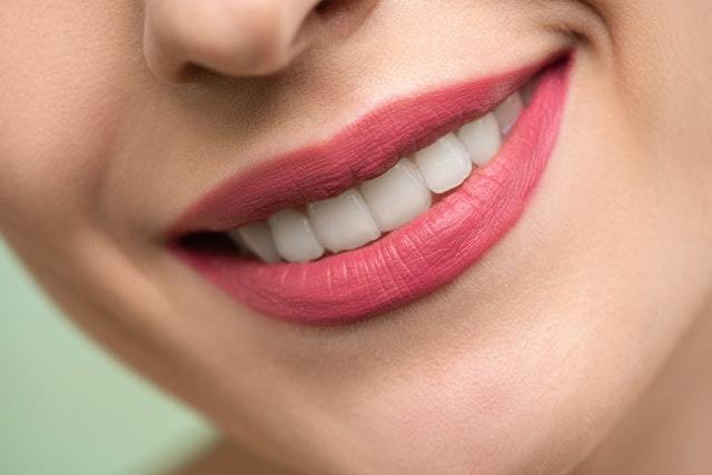 5 tips voor wittere tanden