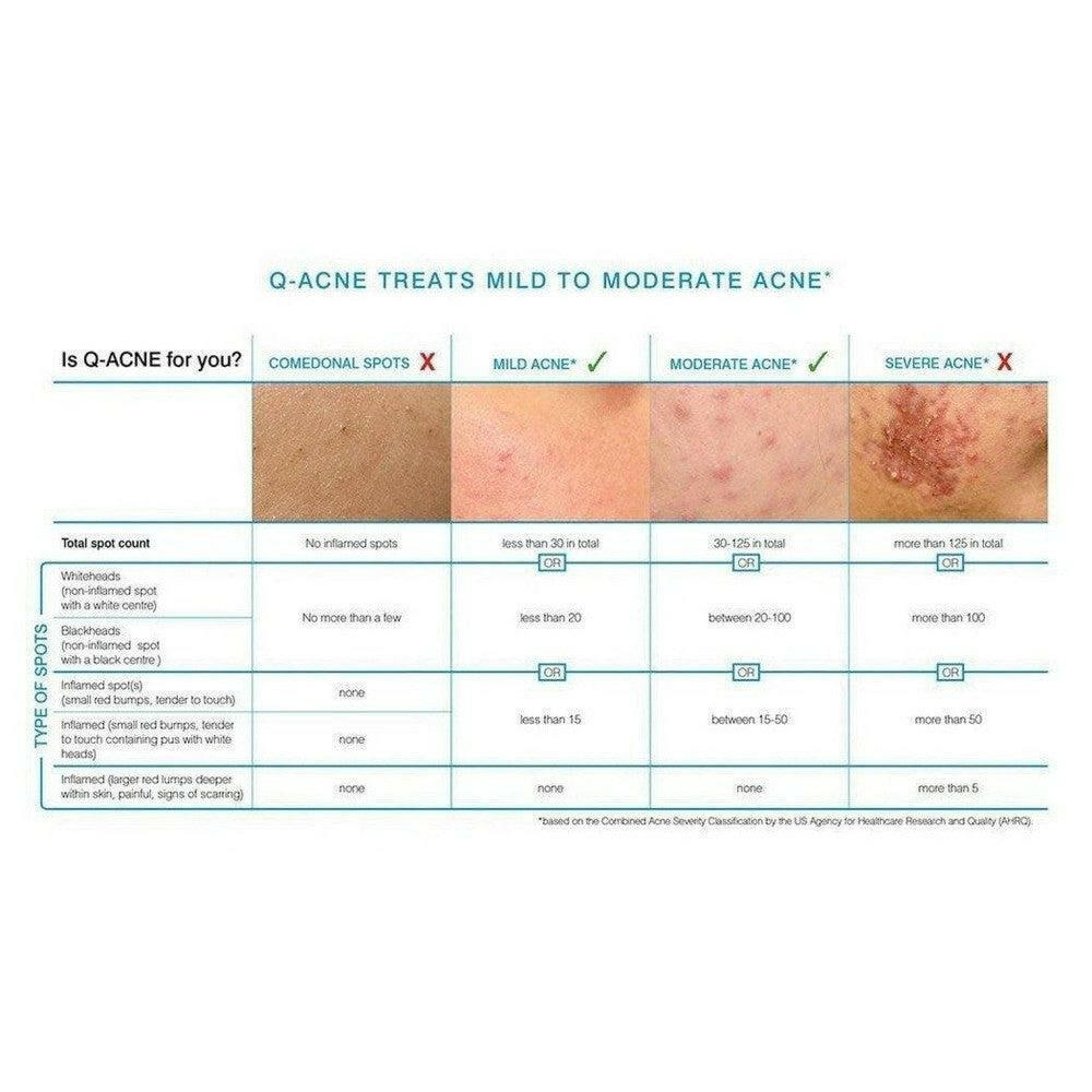 Informatieve tabel over geschiktheid Rio Q-ACNE voor milde tot matige acne
